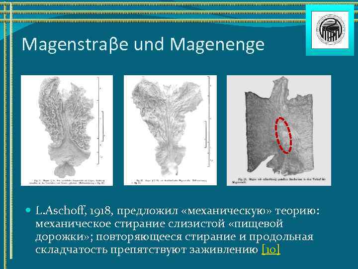 Magenstraβe und Magenenge L. Aschoff, 1918, предложил «механическую» теорию: механическое стирание слизистой «пищевой дорожки»