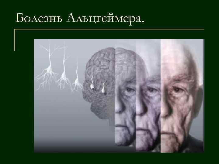 Деменция альцгеймеровского типа. Альцгеймера болезнь Альцгеймера. Болезнь Альцгеймера презентация. Деменция и Альцгеймер.