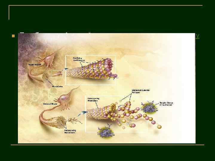 n При болезни Альцгеймера изменения в структуре тау -белка приводят дезинтеграции микротрубочек в клетках
