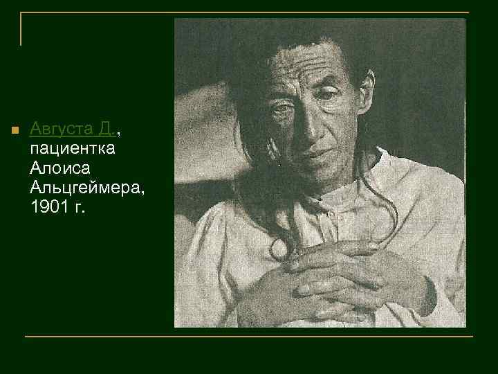 Алоис альцгеймер презентация