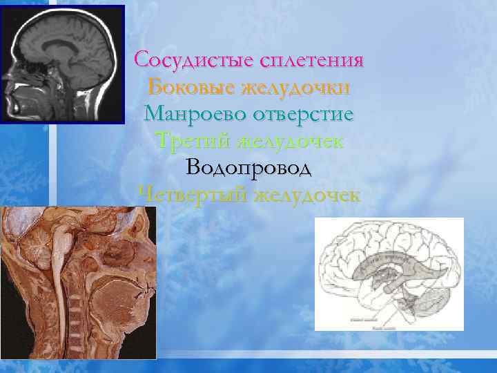 Сосудистые сплетения Боковые желудочки Манроево отверстие Третий желудочек Водопровод Четвертый желудочек 