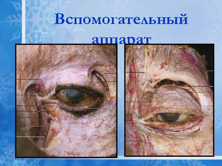 Вспомогательный аппарат 