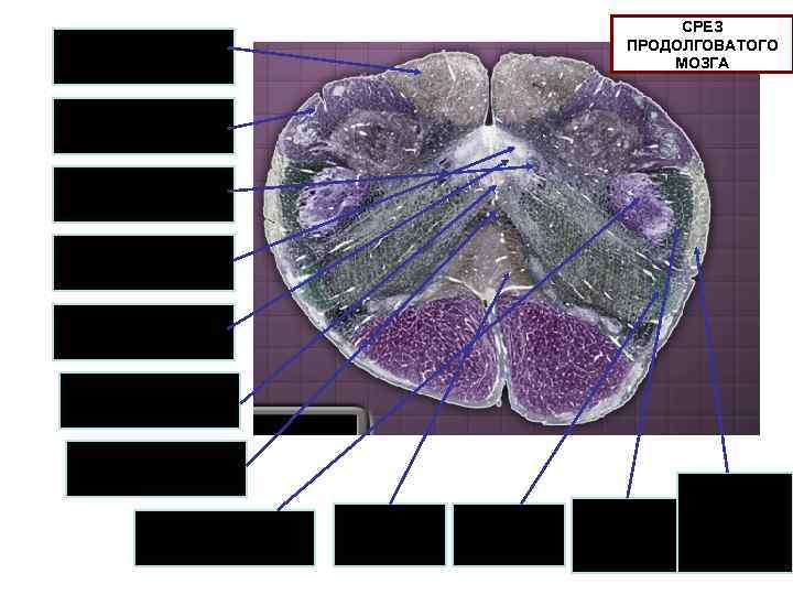 СРЕЗ ПРОДОЛГОВАТОГО МОЗГА Тонкий пучок Клиновидный пучок Одиночный путь Ядро одиночного пути Дорсальное ядро