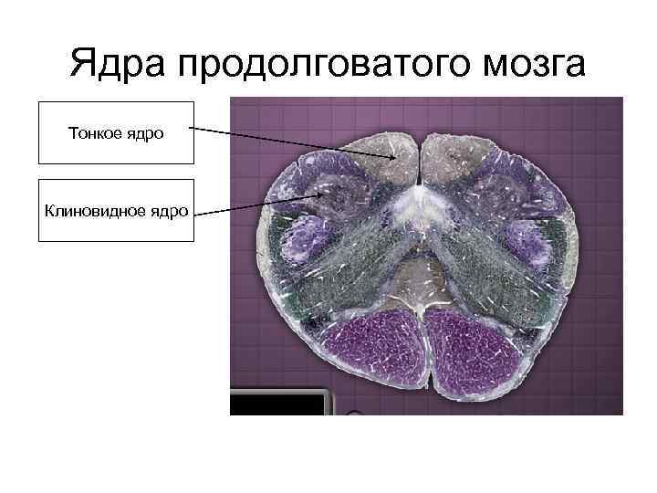 Ядра продолговатого мозга Тонкое ядро Клиновидное ядро 