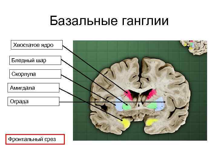 Базальные ганглии Хвостатое ядро Бледный шар Скорлупа Амигдала Ограда Фронтальный срез 