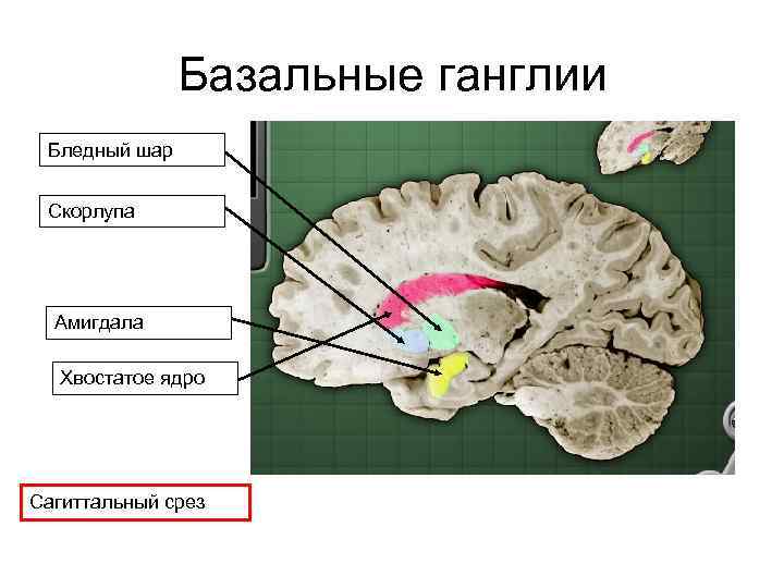 Базальные ганглии Бледный шар Скорлупа Амигдала Хвостатое ядро Сагиттальный срез 