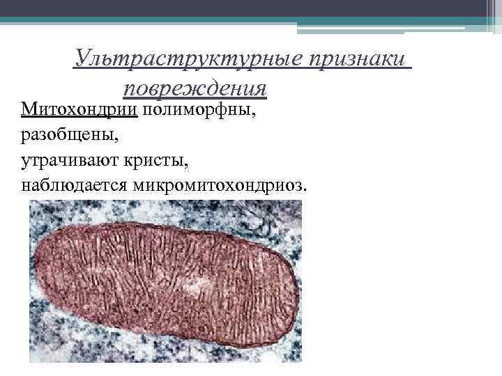 Ультраструктурные признаки повреждения Митохондрии полиморфны, разобщены, утрачивают кристы, наблюдается микромитохондриоз. 