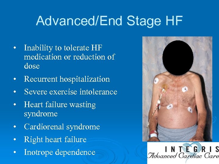 Advanced/End Stage HF • Inability to tolerate HF medication or reduction of dose •