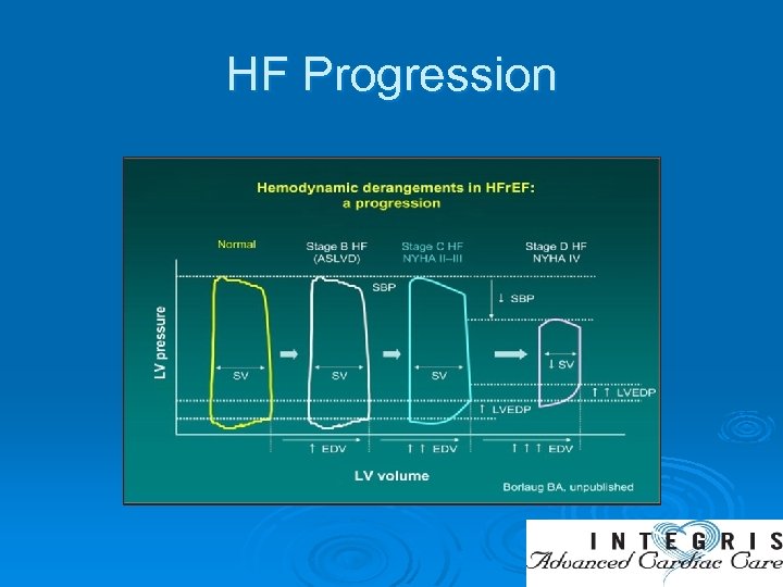 HF Progression 