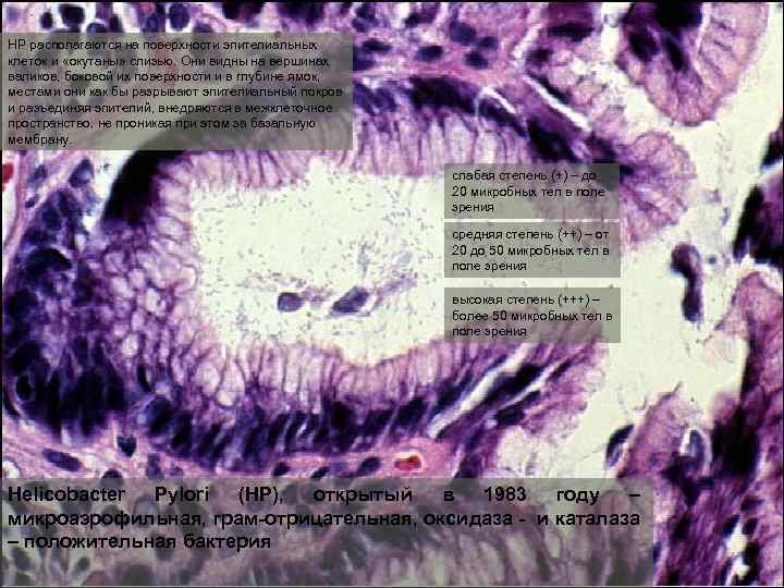 НР располагаются на поверхности эпителиальных клеток и «окутаны» слизью. Они видны на вершинах валиков,