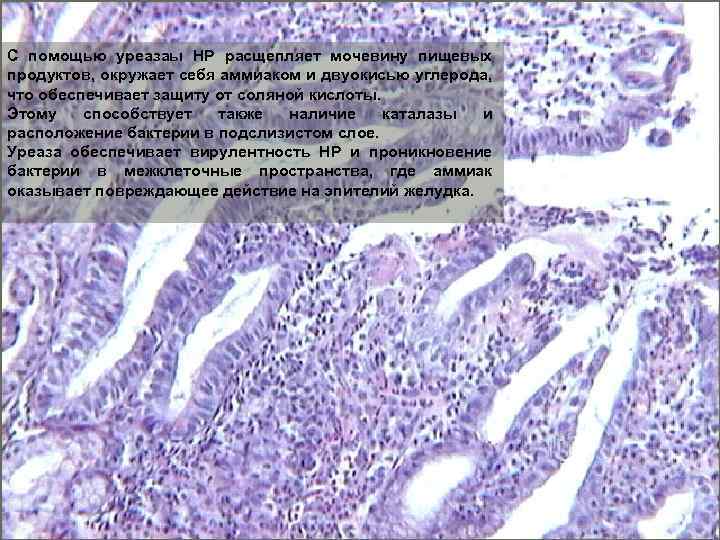 С помощью уреазаы НР расщепляет мочевину пищевых продуктов, окружает себя аммиаком и двуокисью углерода,