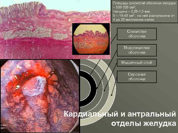 Площадь слизистой оболочки желудка – 526 -525 см 2; толщина – 0, 25 -1,