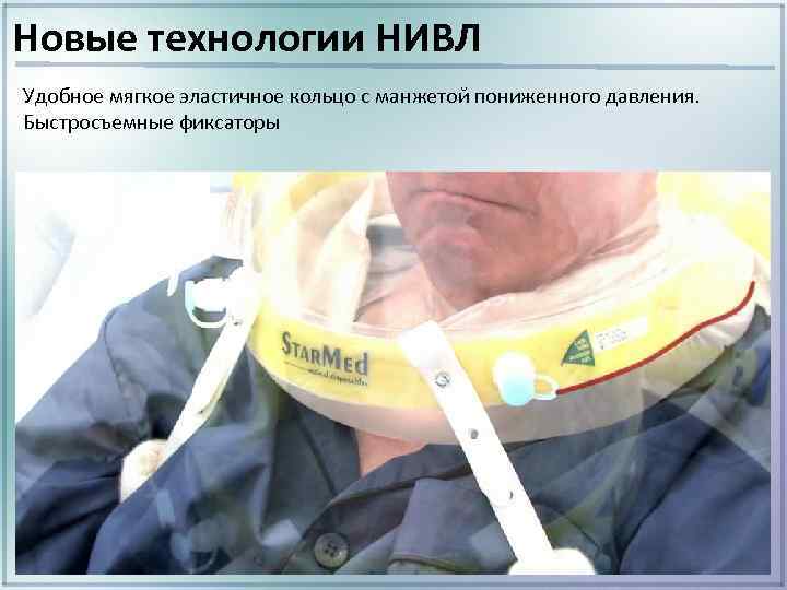 Новые технологии НИВЛ Удобное мягкое эластичное кольцо с манжетой пониженного давления. Быстросъемные фиксаторы 