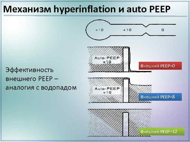 Механизм hyperinflation и auto РЕЕР Эффективность внешнего PEEP – аналогия с водопадом Внешний РЕЕР=0