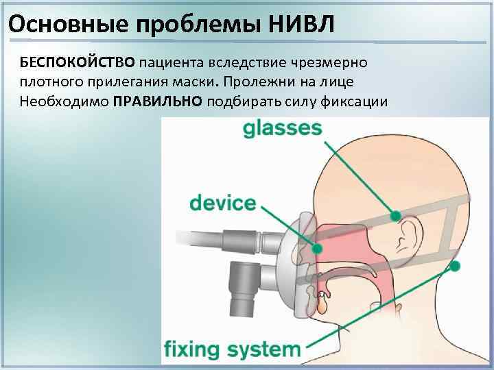 Неинвазивная ивл презентация