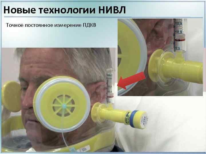 Новые технологии НИВЛ Точное постоянное измерение ПДКВ 
