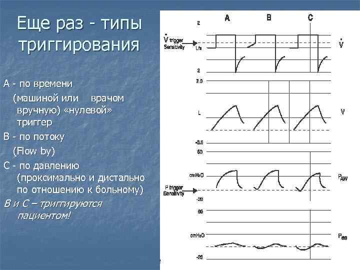 Еще раз - типы триггирования A - по времени (машиной или врачом вручную) «нулевой»