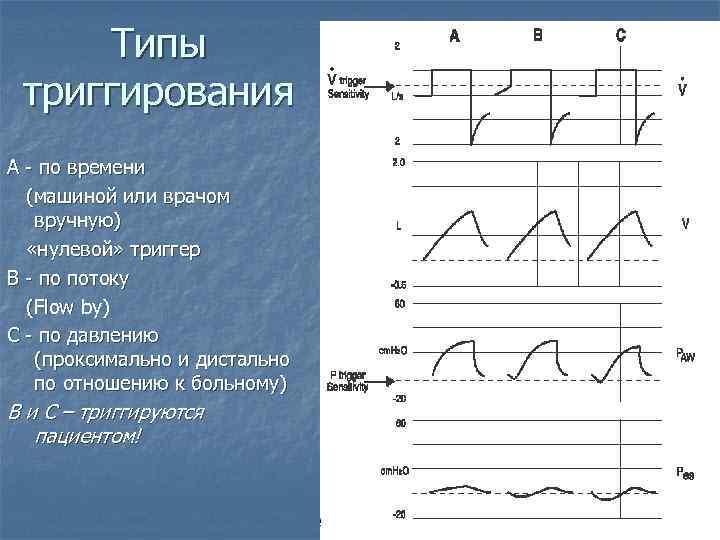 Типы триггирования A - по времени (машиной или врачом вручную) «нулевой» триггер B -