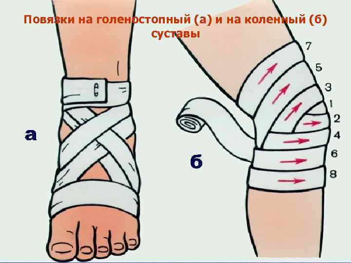 Повязки на голеностопный (а) и на коленный (б) суставы а б 