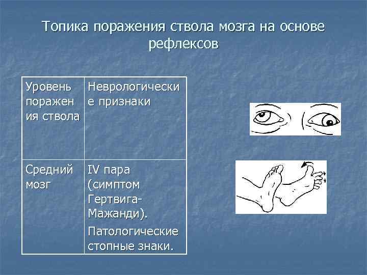 Топика поражения ствола мозга на основе рефлексов Уровень Неврологически поражен е признаки ия ствола