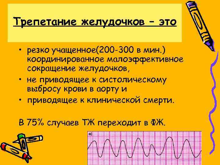 Трепетание желудочков – это • резко учащенное(200 -300 в мин. ) координированное малоэффективное сокращение