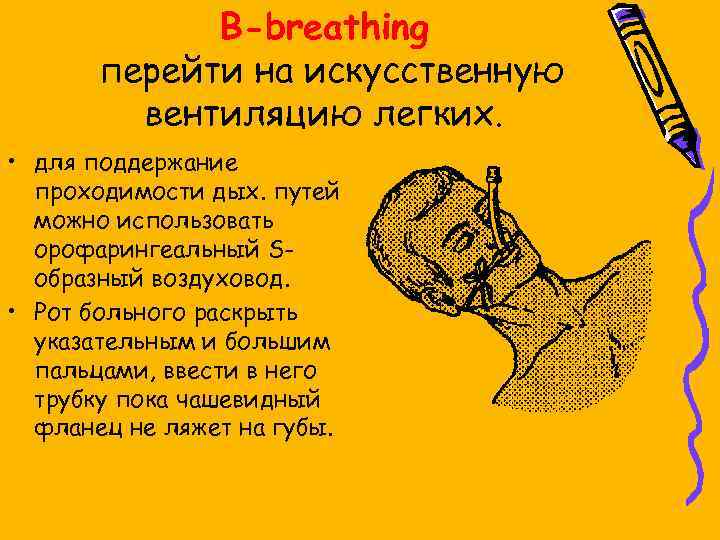 B-breathing перейти на искусственную вентиляцию легких. • для поддержание проходимости дых. путей можно использовать