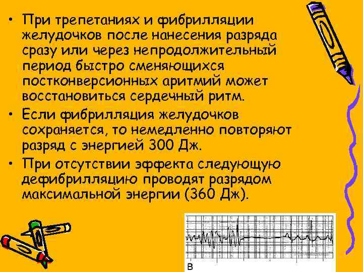  • При трепетаниях и фибрилляции желудочков после нанесения разряда сразу или через непродолжительный