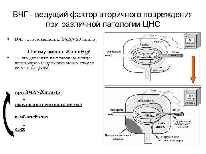 ВЧГ - ведущий фактор вторичного повреждения при различной патологии ЦНС • ВЧГ- это повышение