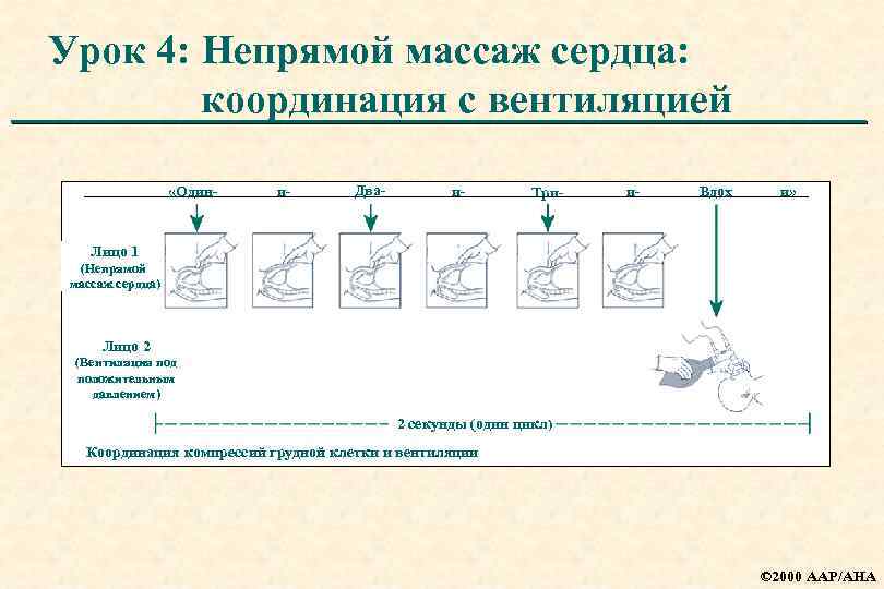 Урок 4: Непрямой массаж сердца: координация с вентиляцией «Один- и- Два- и- Три- и-