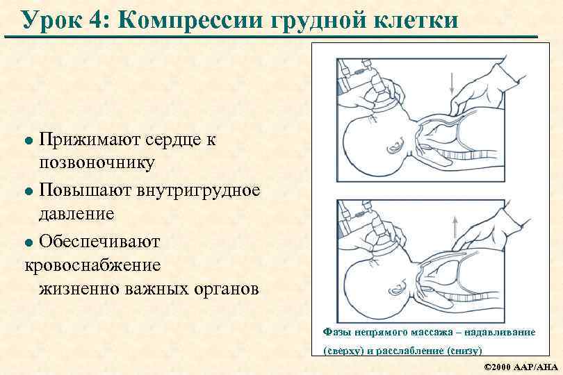 Урок 4: Компрессии грудной клетки Прижимают сердце к позвоночнику l Повышают внутригрудное давление l