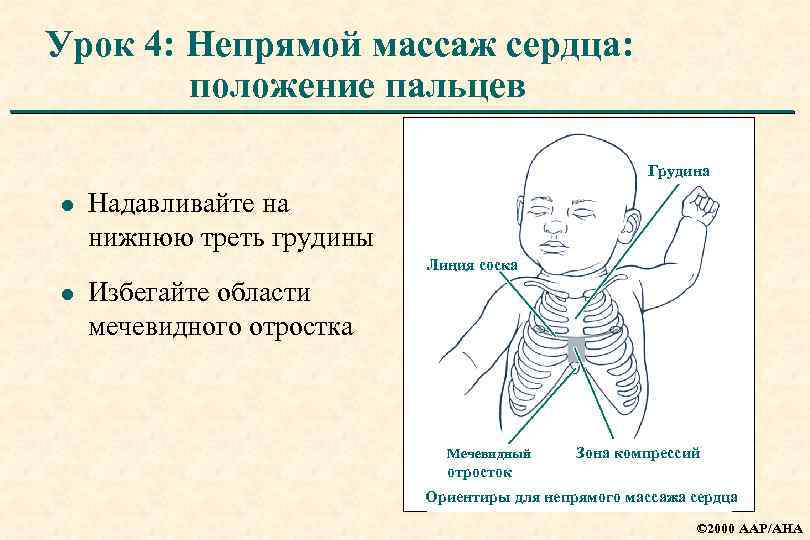 Урок 4: Непрямой массаж сердца: положение пальцев Грудина l Надавливайте на нижнюю треть грудины