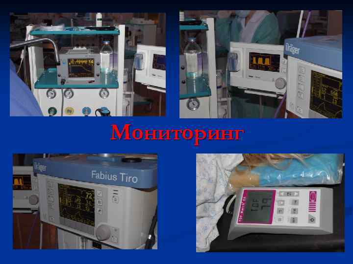 Мониторинг 