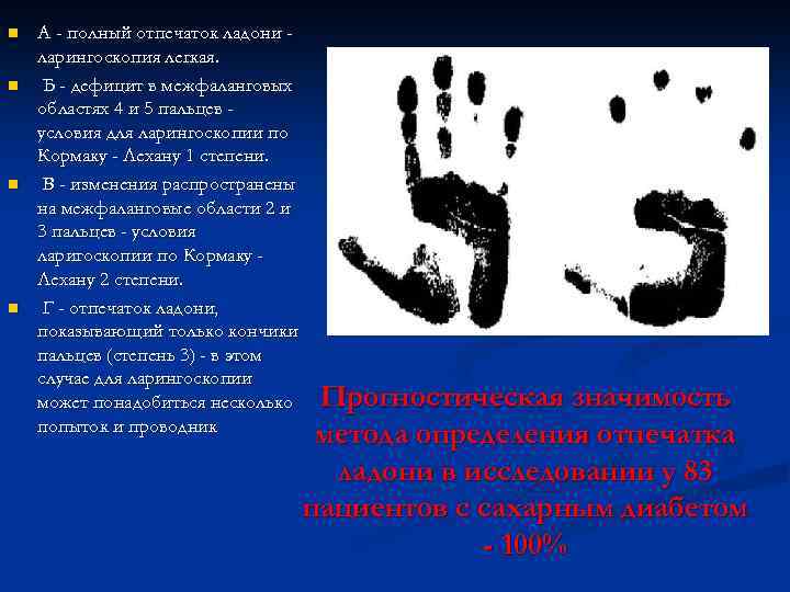 n n А - полный отпечаток ладони ларингоскопия легкая. Б - дефицит в межфаланговых