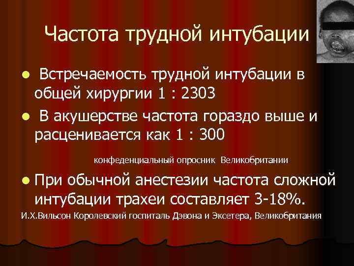 Частота трудной интубации Встречаемость трудной интубации в общей хирургии 1 : 2303 l В