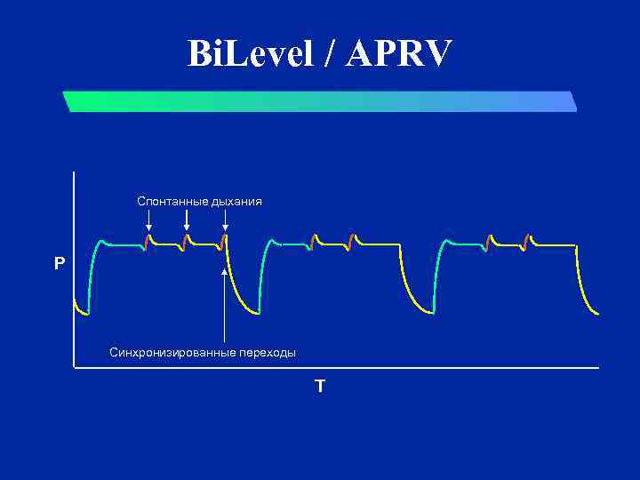 Bi. Level / APRV Спонтанные дыхания P Синхронизированные переходы T 