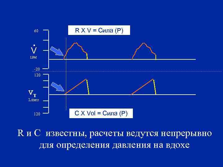60 . . R X V = Сила (P) V LPM -20 120 VT