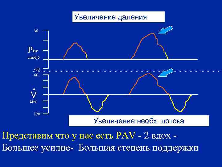Увеличение даления 30 Paw cm. H 20 -20 60 . V LPM 120 Увеличение