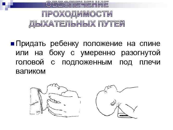 n Придать ребенку положение на спине или на боку с умеренно разогнутой головой с