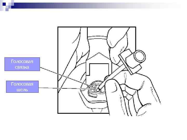 Голосовая связка Голосовая щель 