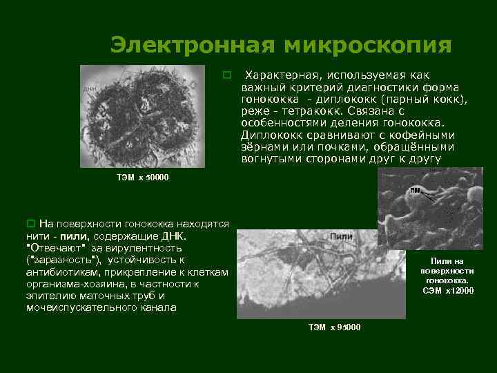 Электронная микроскопия o Характерная, используемая как важный критерий диагностики форма гонококка - диплококк (парный