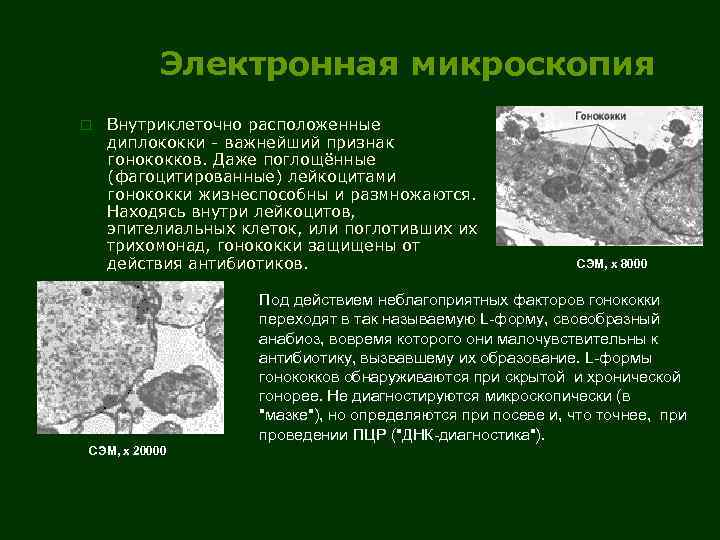 Электронная микроскопия o Внутриклеточно расположенные диплококки - важнейший признак гонококков. Даже поглощённые (фагоцитированные) лейкоцитами