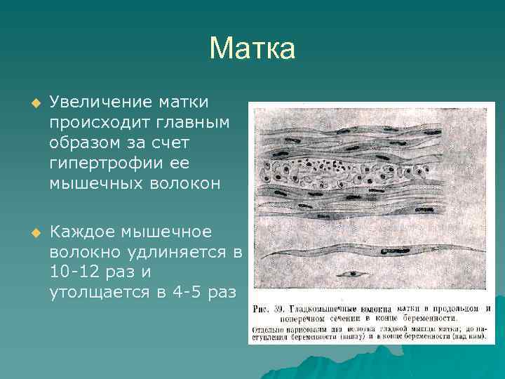 Матка u Увеличение матки происходит главным образом за счет гипертрофии ее мышечных волокон u