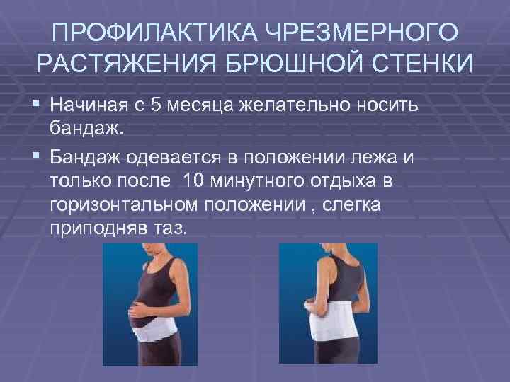 ПРОФИЛАКТИКА ЧРЕЗМЕРНОГО РАСТЯЖЕНИЯ БРЮШНОЙ СТЕНКИ § Начиная с 5 месяца желательно носить бандаж. §