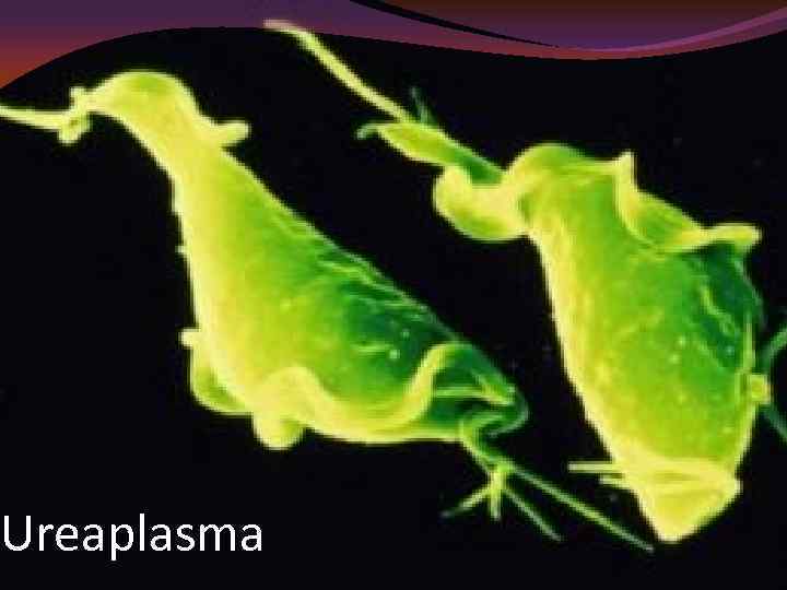 Ureaplasma 