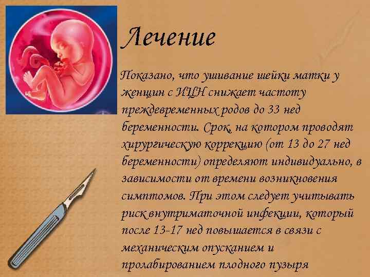 Лечение Показано, что ушивание шейки матки у женщин с ИЦН снижает частоту преждевременных родов