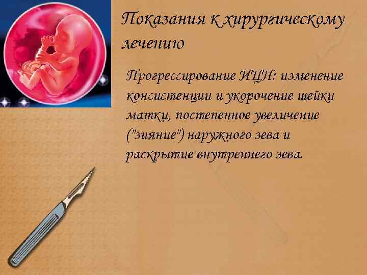 Показания к хирургическому лечению Прогрессирование ИЦН: изменение консистенции и укорочение шейки матки, постепенное увеличение