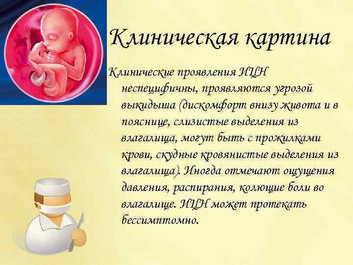 Клиническая картина Клинические проявления ИЦН неспецифичны, проявляются угрозой выкидыша (дискомфорт внизу живота и в