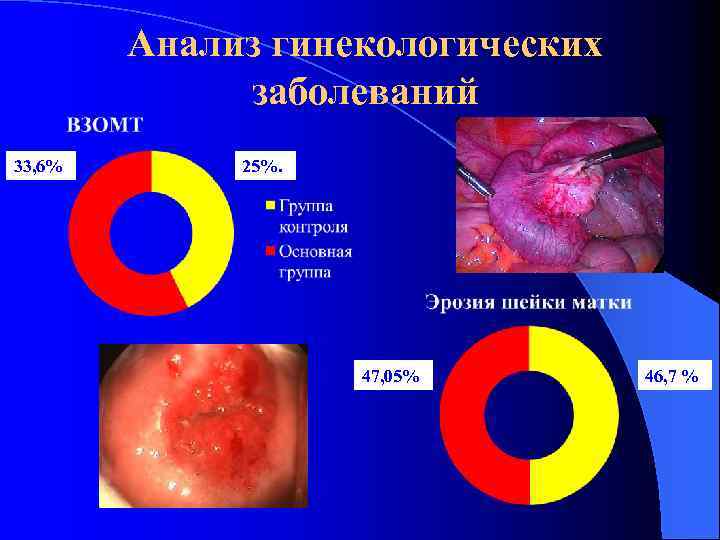 Анализ гинекологических заболеваний 33, 6% 25%. 47, 05% 46, 7 % 