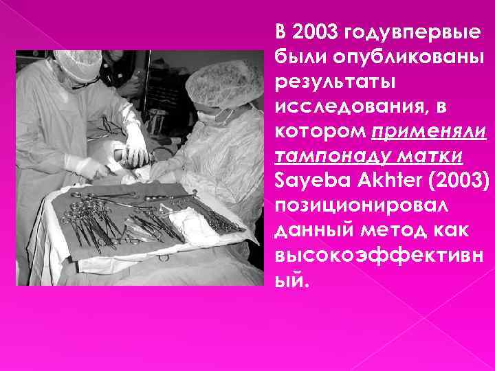 В 2003 годувпервые были опубликованы результаты исследования, в котором применяли тампонаду матки Sayeba Akhter
