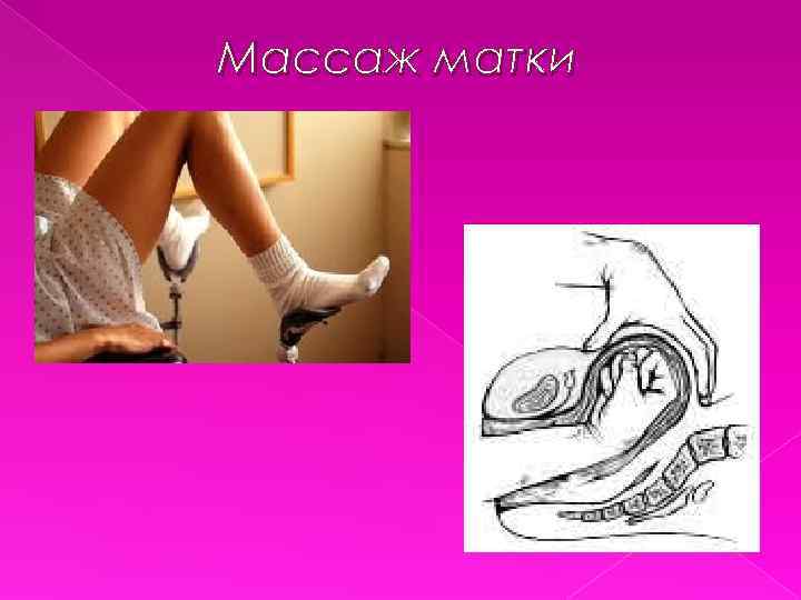 Массаж матки 
